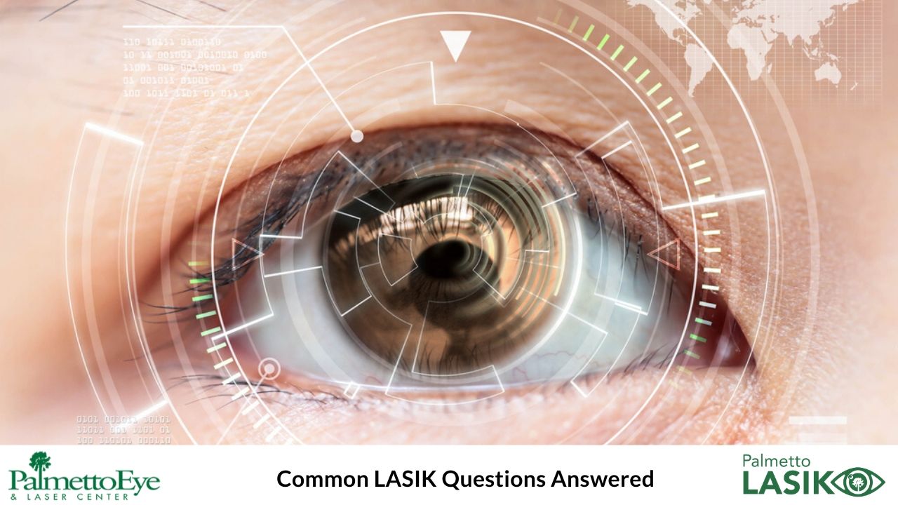 Common LASIK Questions Answered