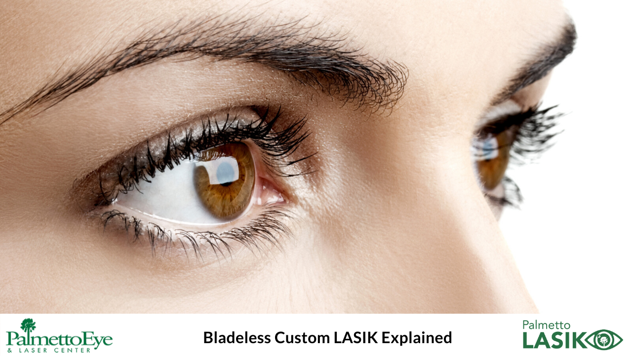 Bladeless LASIK